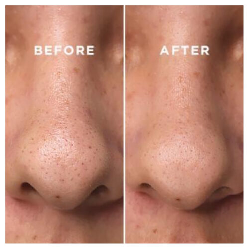 [CosRX] Two in One Poreless Power Liquid - Imagen 3