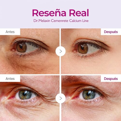 [Dr.Melaxin] Calcium Volume Eye Patch 60 parches - Imagen 3